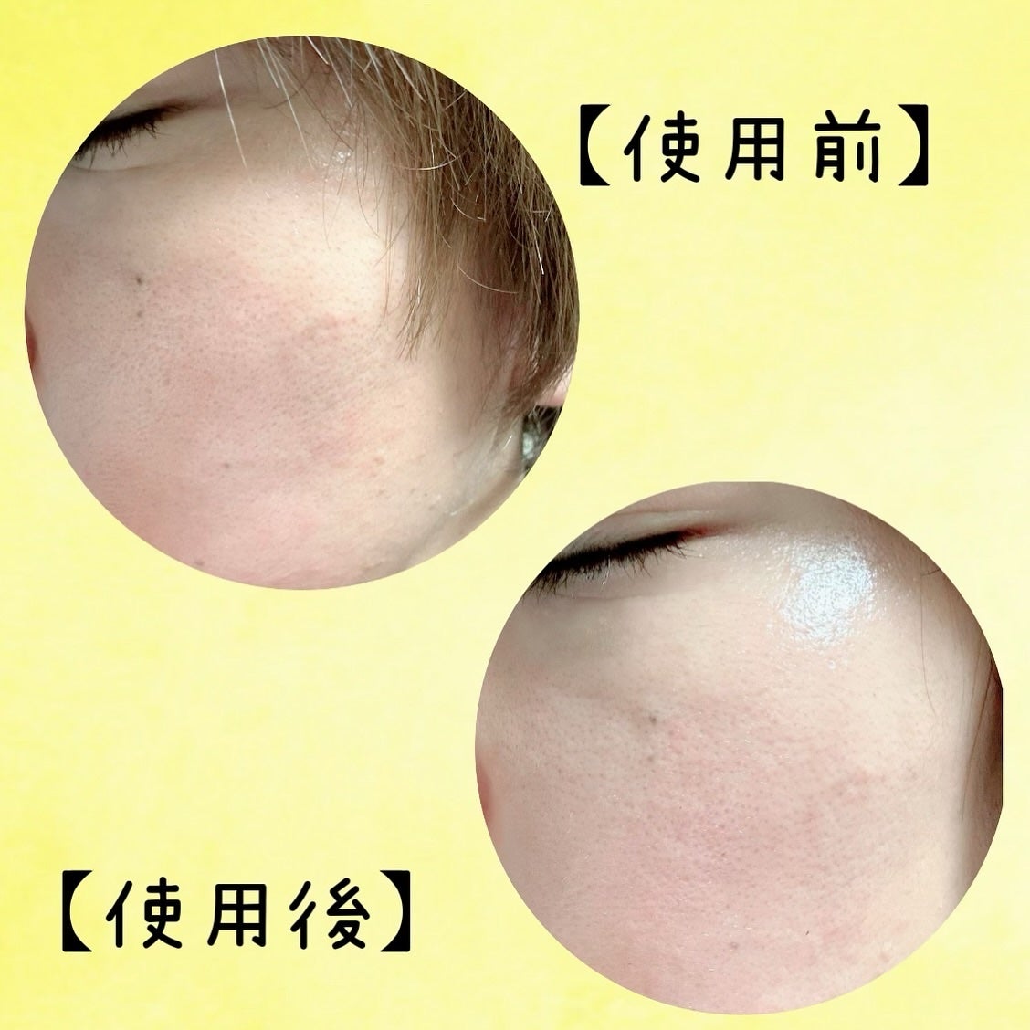 ダイヤリフト1000 SHOT/ECLIMOI/ブースター・導入液を使ったクチコミ(6枚目)