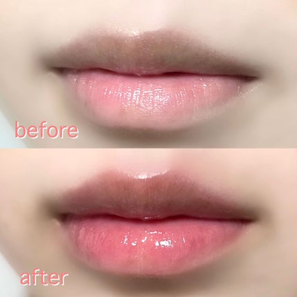 ドトムリッププラスプランパー/keybo/リッププランパーを使ったクチコミ(2枚目)