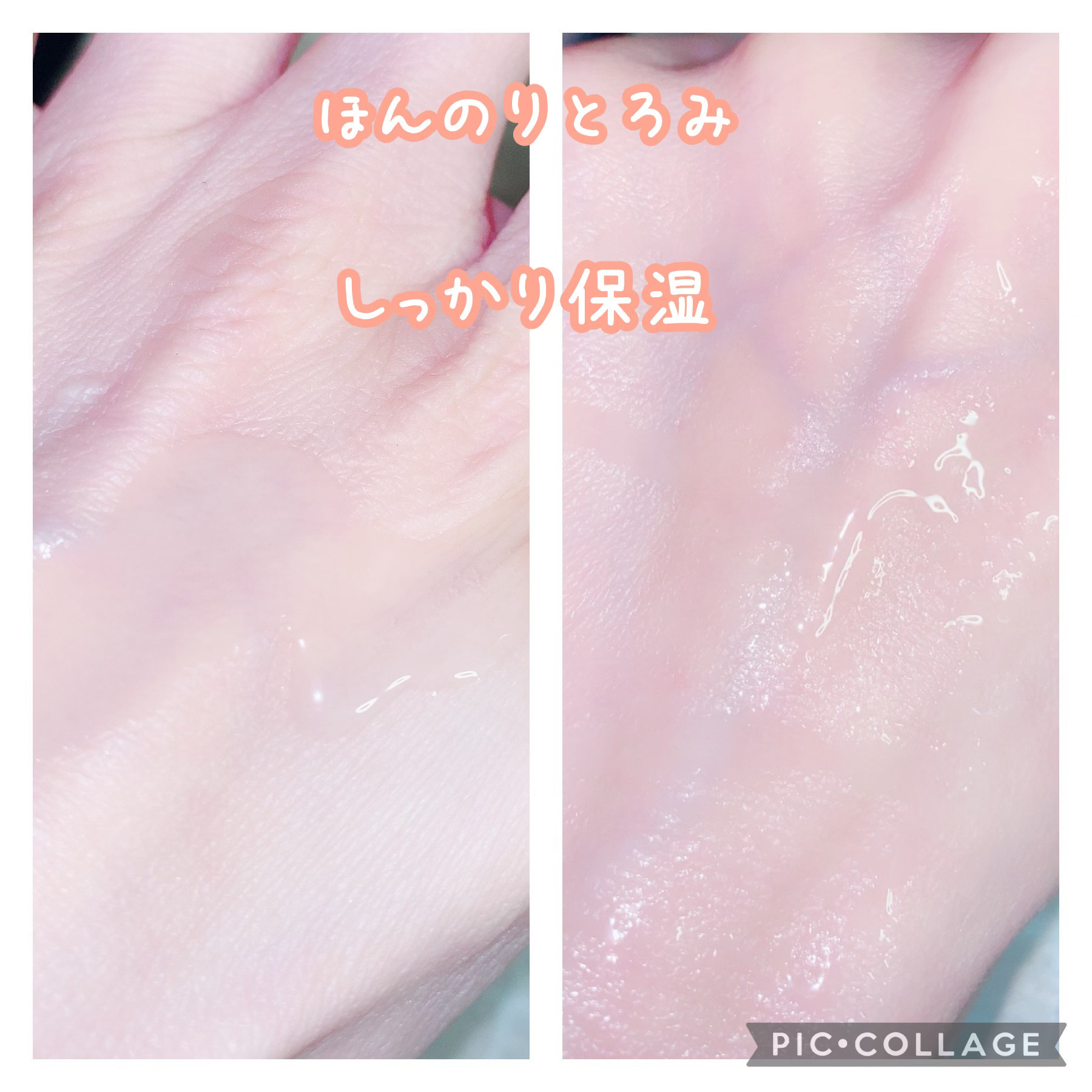 モイストケア ローション MB/d プログラム/化粧水を使ったクチコミ（3枚目）