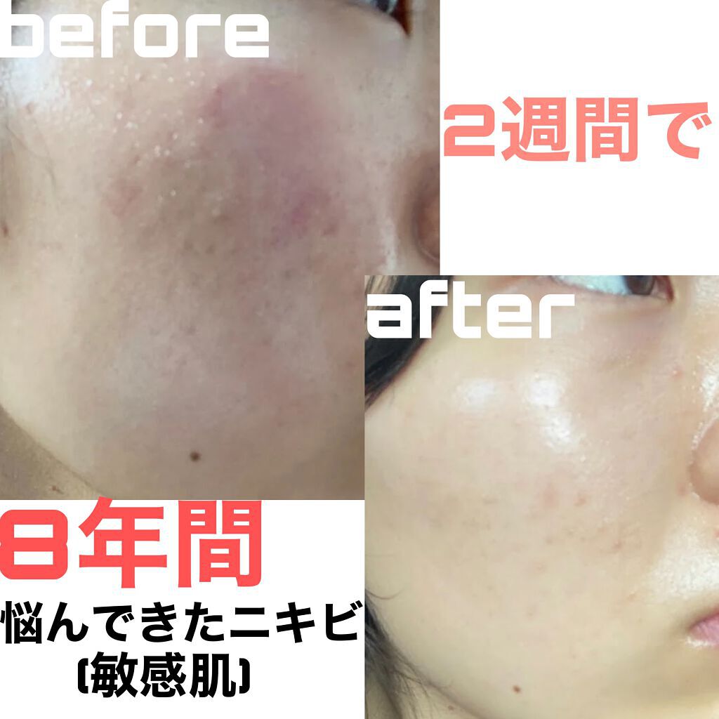 ウオーター/アベンヌ/ミスト状化粧水を使ったクチコミ(1枚目)