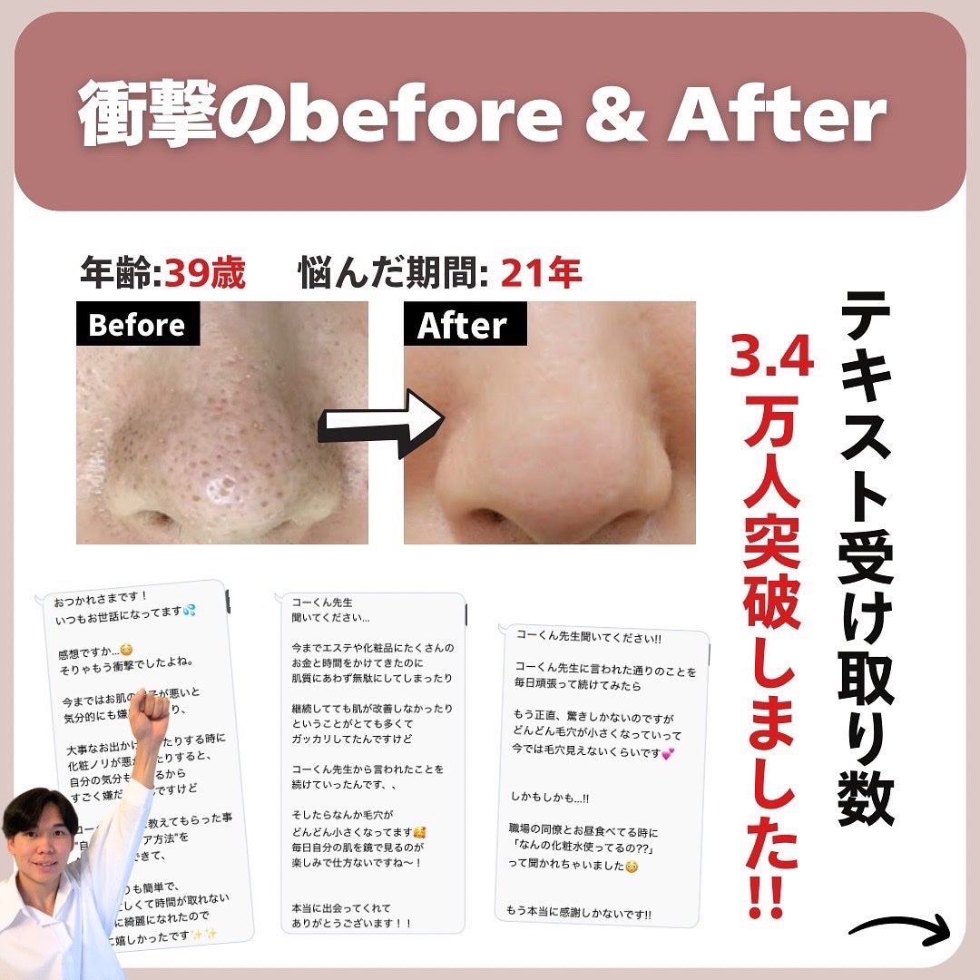 あなたの肌に合ったスキンケア💐コーくん先生 on LIPS 「【コレ知らない人まじ危険】こんな人は毛穴一生消えません。..あ..」(7枚目)