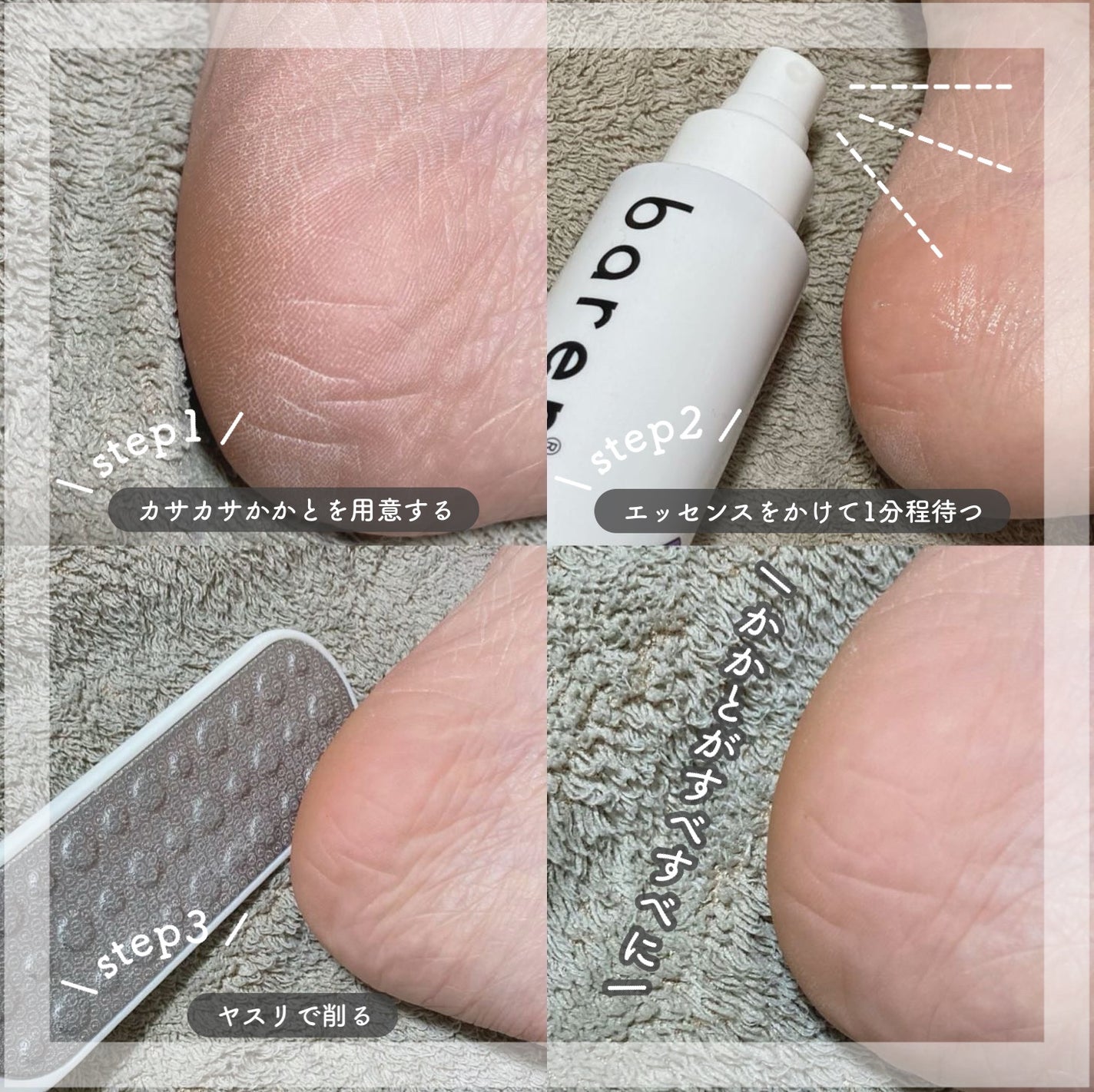 フットケアセット/BAREN/その他キットセットを使ったクチコミ(3枚目)