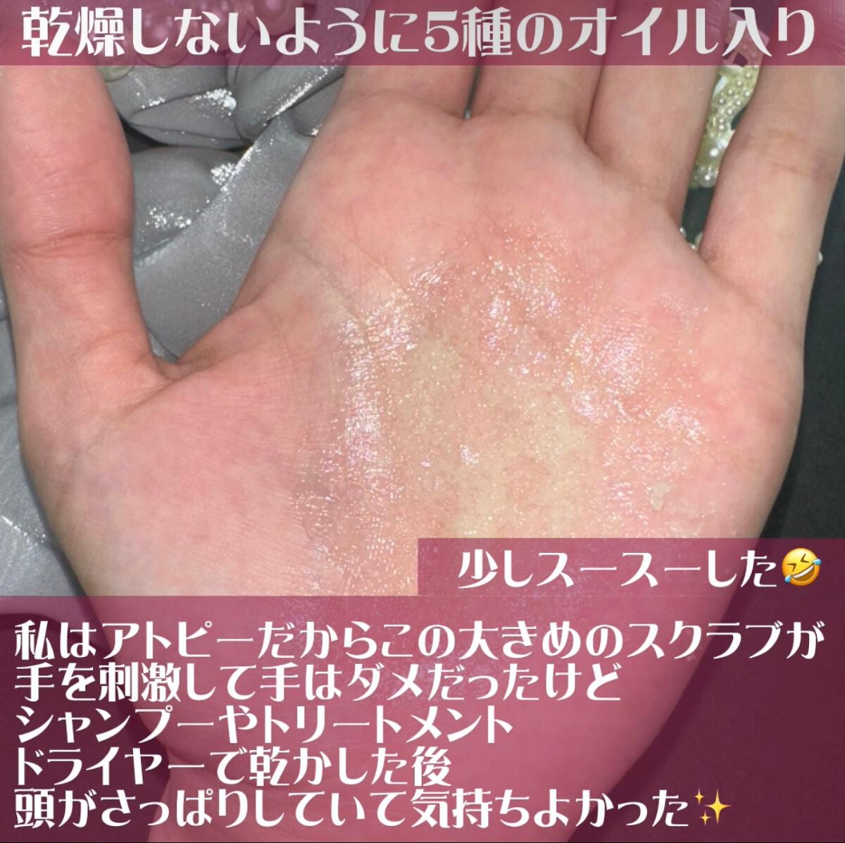 ヘッドスクラブ/shareloù/ヘッドスクラブを使ったクチコミ(3枚目)