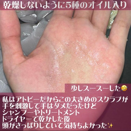 ヘッドスクラブ/shareloù/ヘッドスクラブを使ったクチコミ(3枚目)