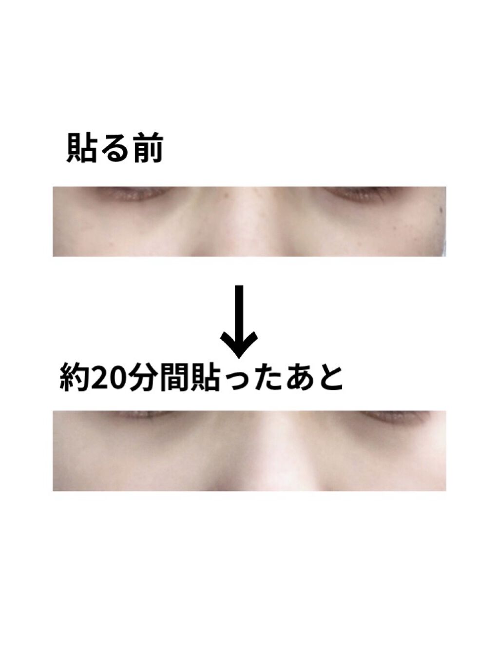 ノンクマ/ビー・エヌ/シートマスク・パックを使ったクチコミ（3枚目）