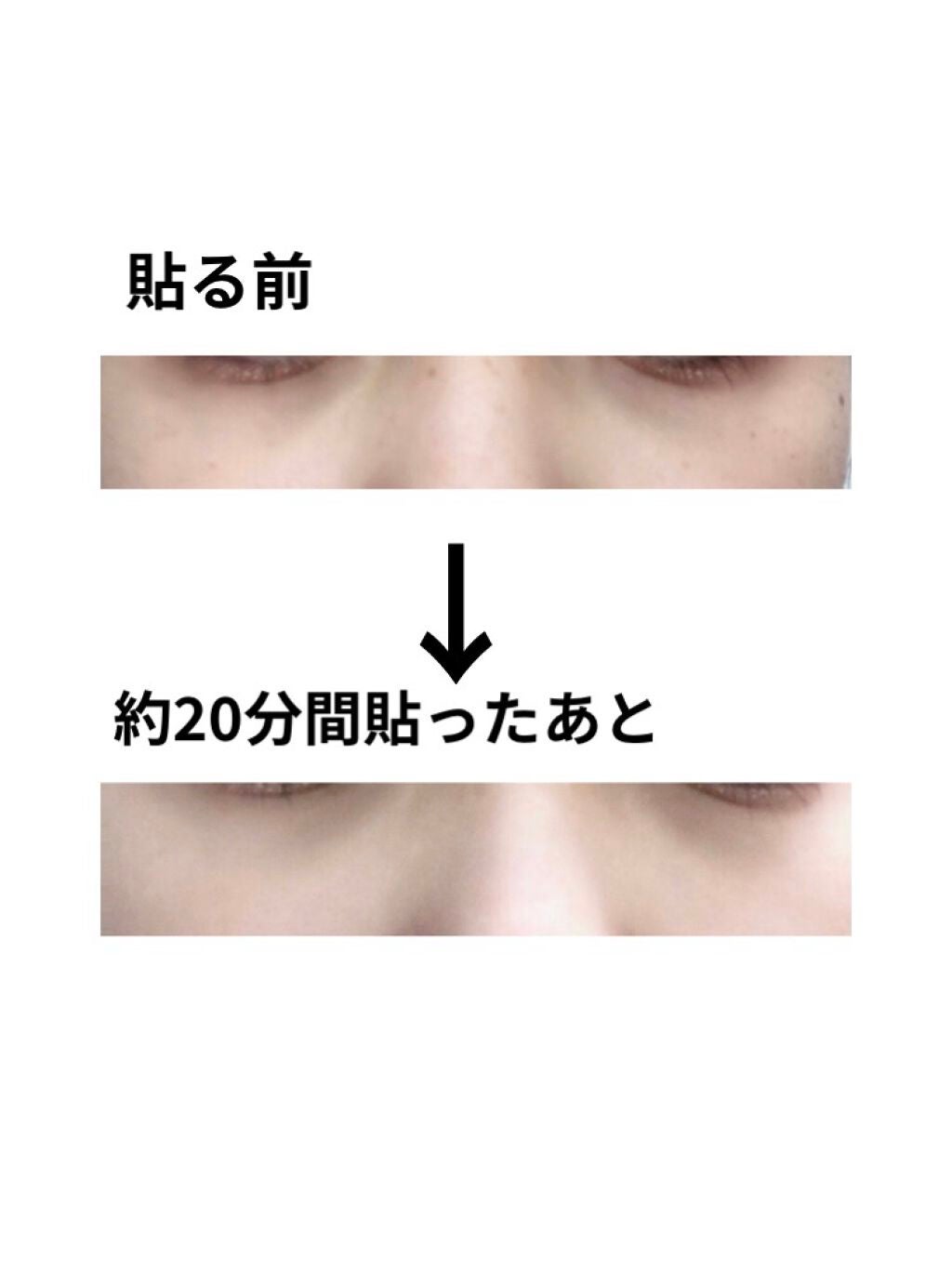 ノンクマ/ビー・エヌ/シートマスク・パックを使ったクチコミ(3枚目)