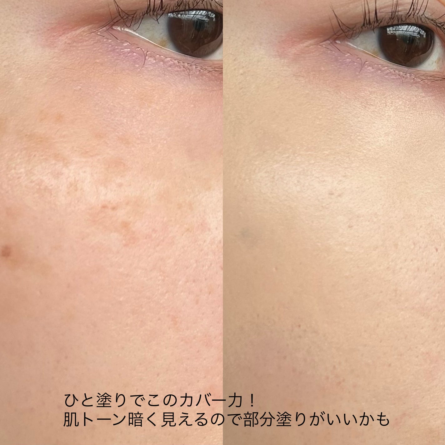 ピンクティーツリーカバーアップグロウクッション/APLIN/クッションファンデーションを使ったクチコミ(5枚目)