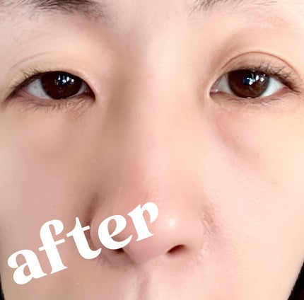 携帯用アイラッシュカーラー/無印良品/ビューラーを使ったクチコミ(4枚目)