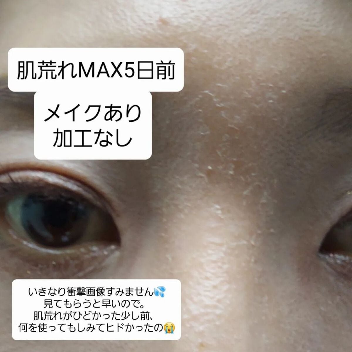 エイシカ365クイックマスクパッド/AESTURA/トナーパッドを使ったクチコミ(2枚目)