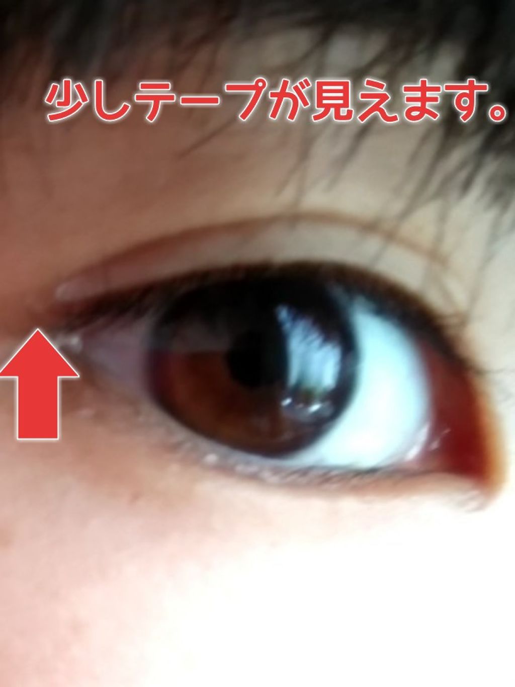シングルアイテープ/Automatic Beauty/二重まぶた用アイテムを使ったクチコミ（2枚目）