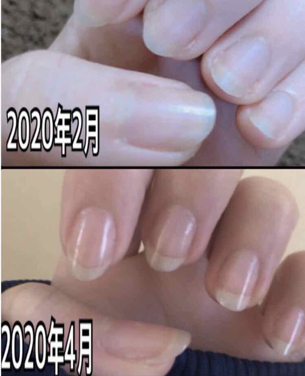 エテュセ クイックケアコート/ettusais/ネイルオイル・トリートメントを使ったクチコミ(4枚目)