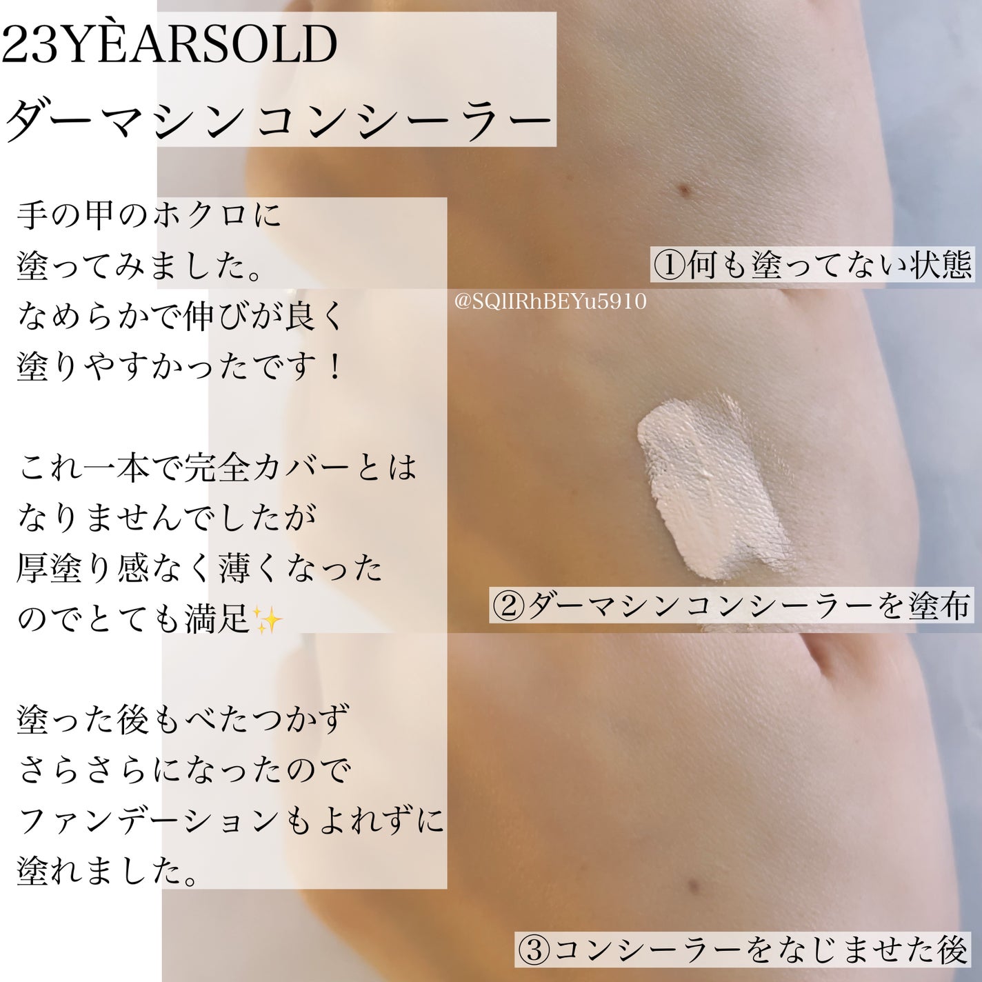 ダーマシンコンシーラー/23years old/リキッドコンシーラーを使ったクチコミ(3枚目)