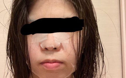 ヒト幹細胞フェイスマスク/アロヴィヴィ/シートマスク・パックを使ったクチコミ(2枚目)