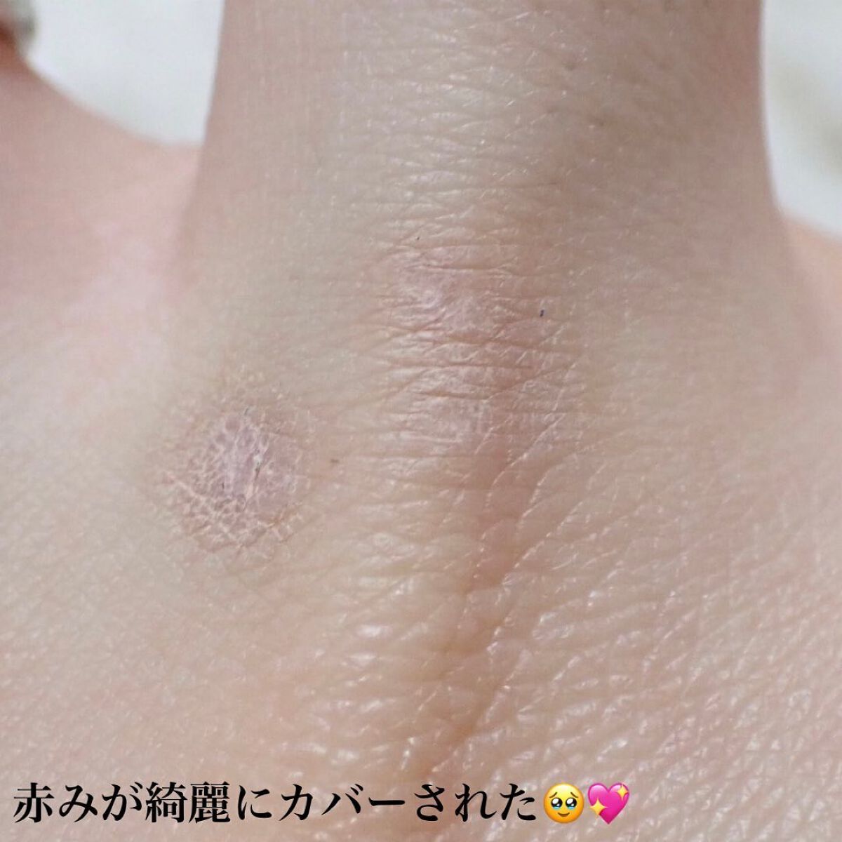 カバーパーフェクション コンシーラー ペンシル/the SAEM/ペンシルコンシーラーを使ったクチコミ(7枚目)