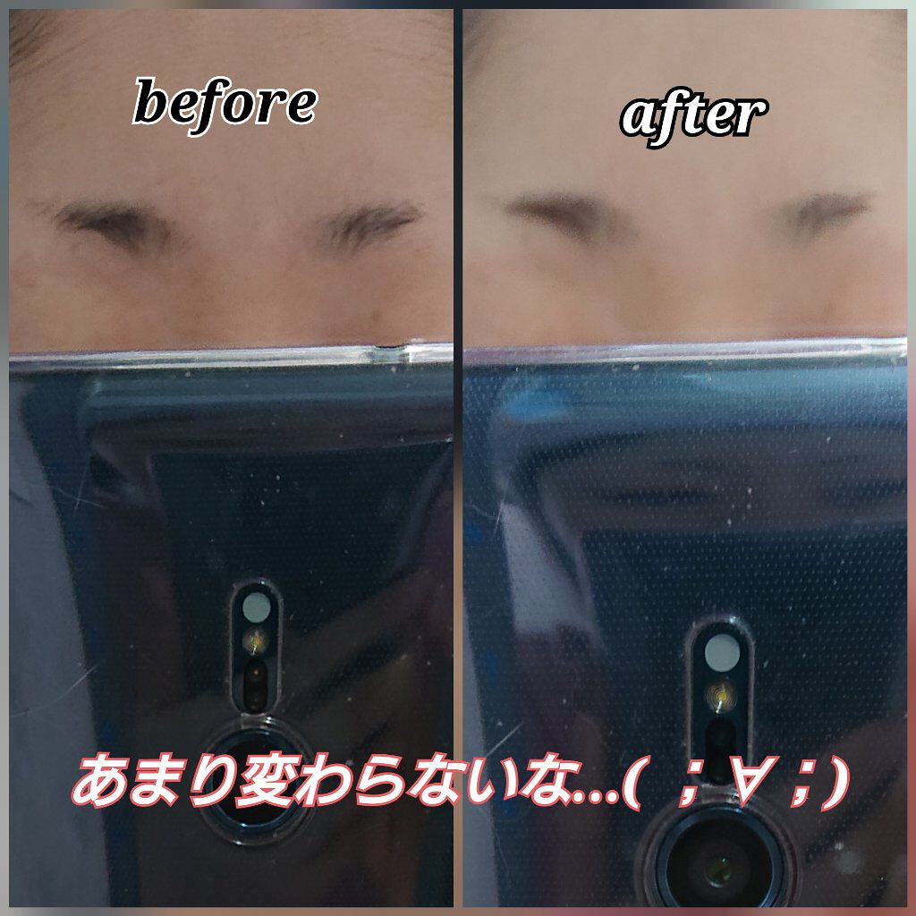 脱色クリーム 敏感肌用/エピラット/ムダ毛ケアを使ったクチコミ（3枚目）