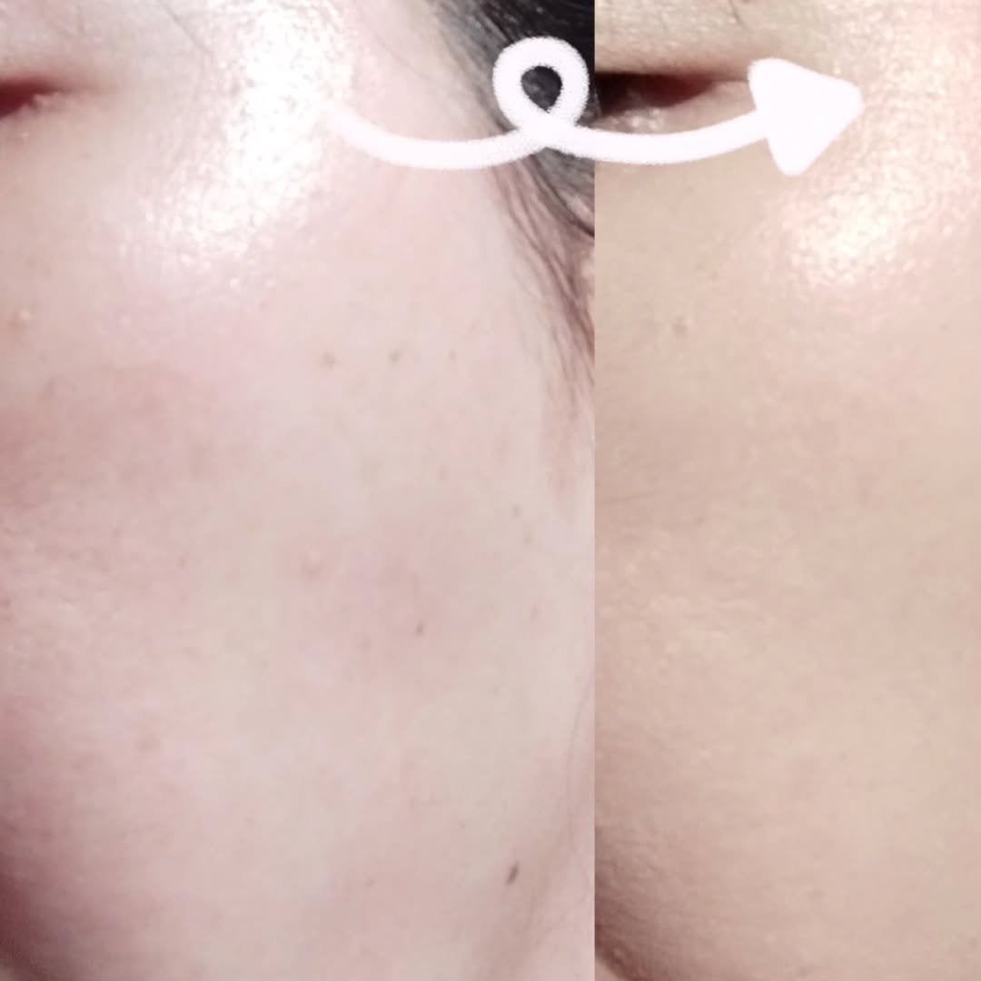 フィクシングヌードフィットクッション/too cool for school/クッションファンデーションを使ったクチコミ(4枚目)