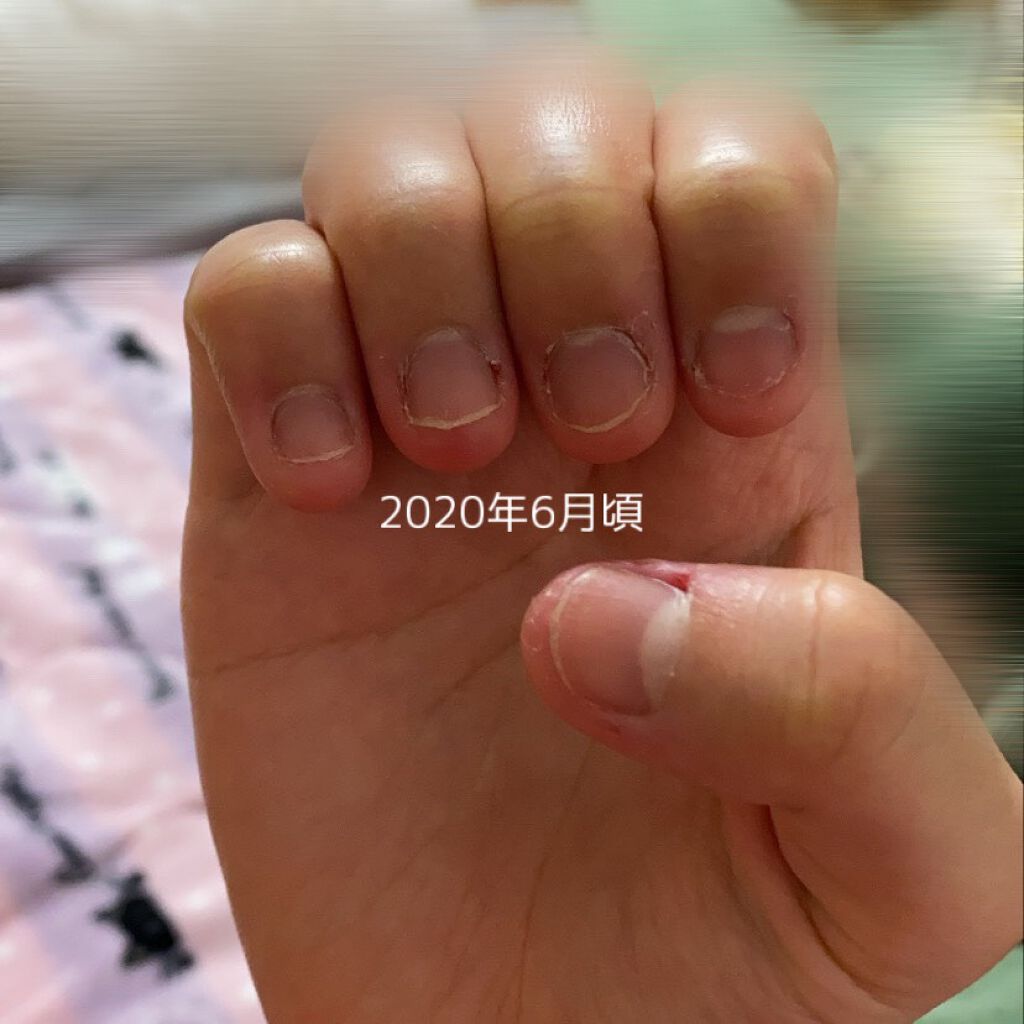 ウィンマックス キューティクルオイル/DAISO/ネイルオイル・トリートメントを使ったクチコミ（2枚目）