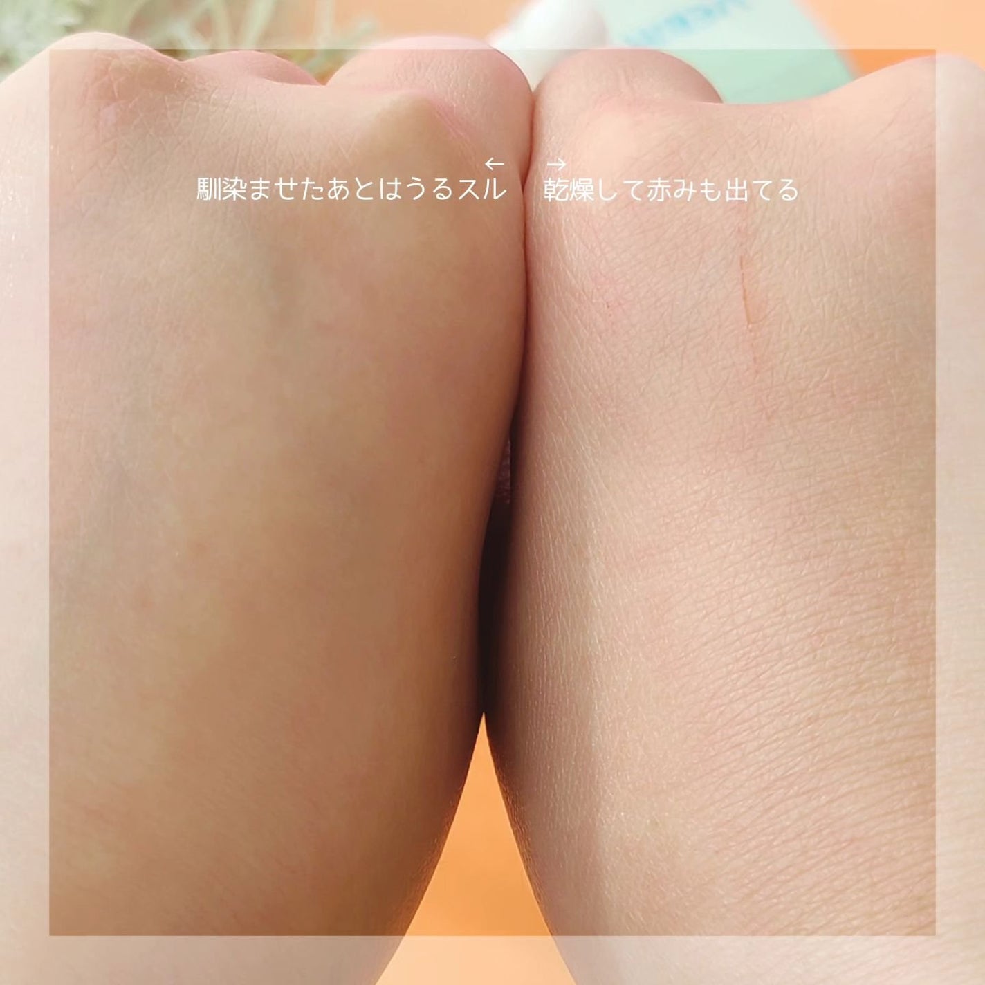 ティーツリーヒアルロン酸オイルフリーアンプル/Vertty/美容液を使ったクチコミ(4枚目)