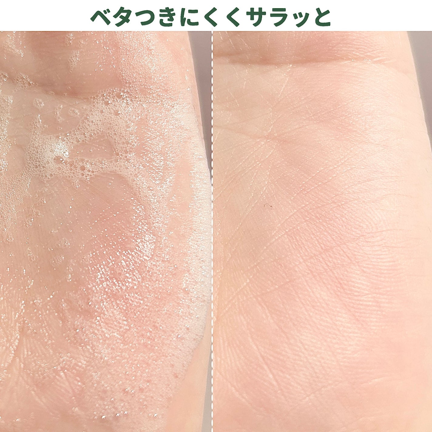 バイタルイミュンショットファーストバブルセラム/SKIN SIGNAL/美容液を使ったクチコミ(4枚目)