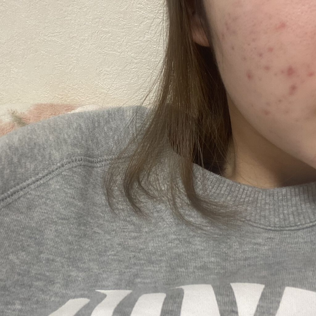 を使ったクチコミ（1枚目）