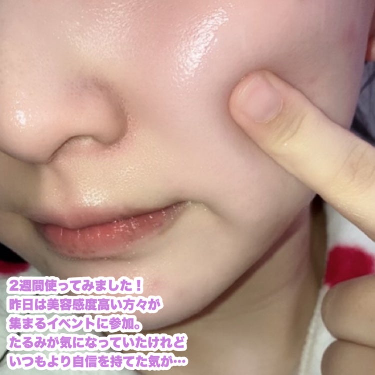 9番 NMNバイオリフト濃縮美容液/numbuzin/美容液を使ったクチコミ(2枚目)