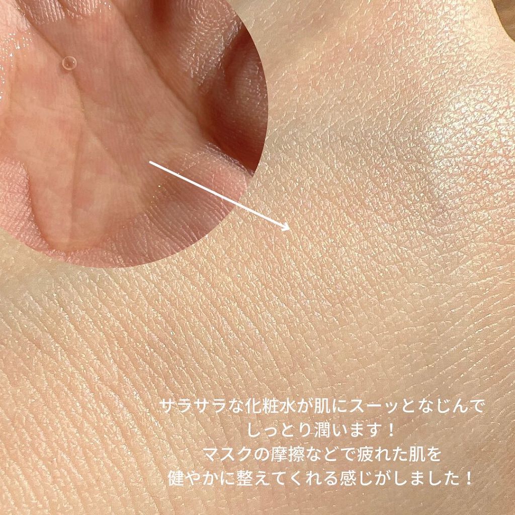 ピンクティーツリートナー/APLIN/化粧水を使ったクチコミ(4枚目)