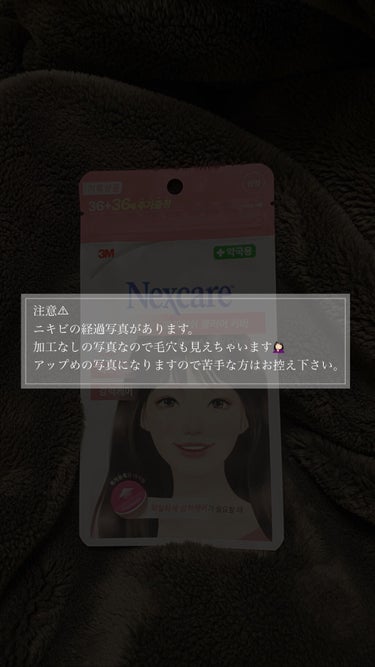 Nexcare/3M nexcare/にきびパッチを使ったクチコミ（3枚目）