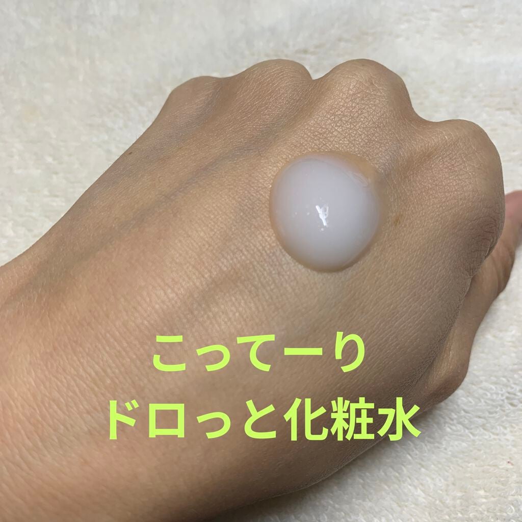 プレミアムローションプラスマイルド/メコゾーム/化粧水を使ったクチコミ(4枚目)