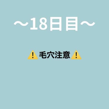 〜18日目〜

ご覧いただきありがとうございます😄

〜今日したスキンケア〜

・ビフェスタ泡洗顔

洗顔はこれで安定です☺️確実にニキビはできにくくなります！よくふれば振るほど泡がモコモコということに