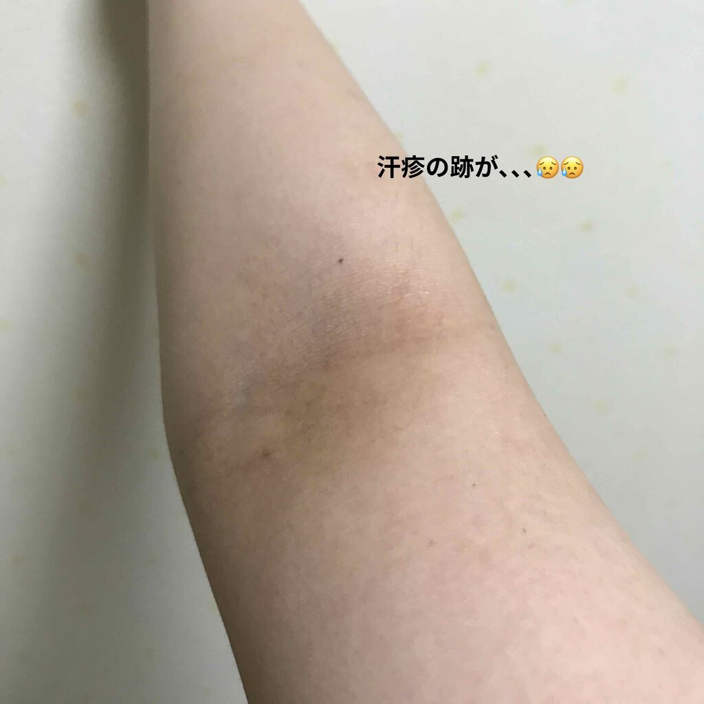 恋するおしり ヒップケアソープ ペリカン石鹸を使った口コミ カミソリ アトピーでやってもうた肌を何とかしたい浪人生の毎日記録 By 敏感肌 代前半 Lips 恋するおしり ヒップケアソープ ペリカン石鹸を使った口コミ カミソリ アトピーでやってもうた肌を何とかしたい浪人生の毎日記録 By 敏感肌 代前半 Lips