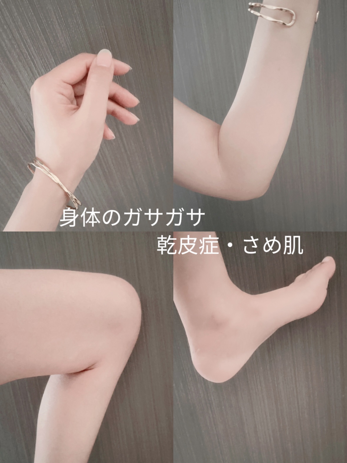 U20クリーム(医薬品)/メンターム/その他を使ったクチコミ（2枚目）