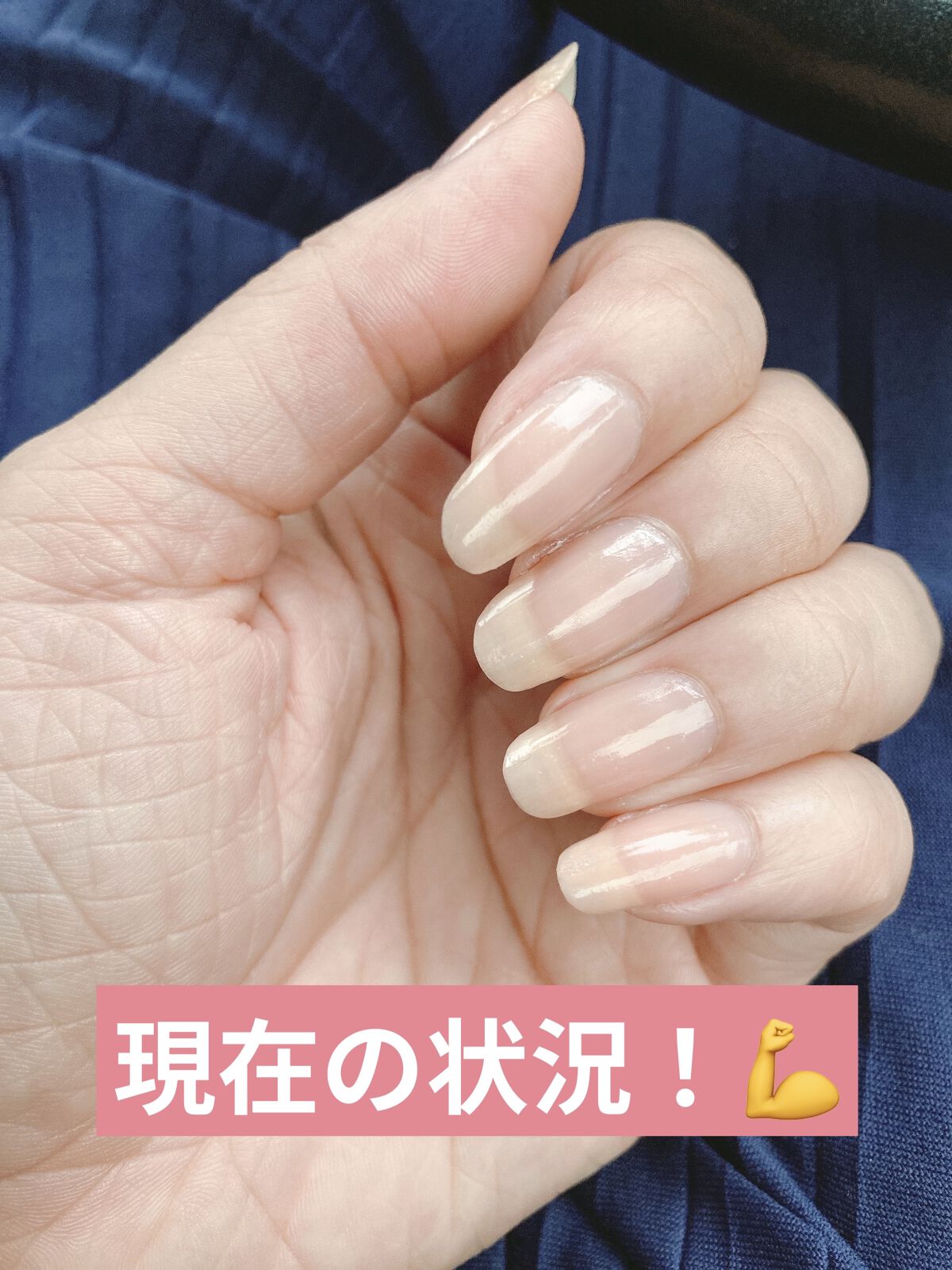 シア ネイルオイル/L'OCCITANE/ネイルオイル・トリートメントを使ったクチコミ（3枚目）