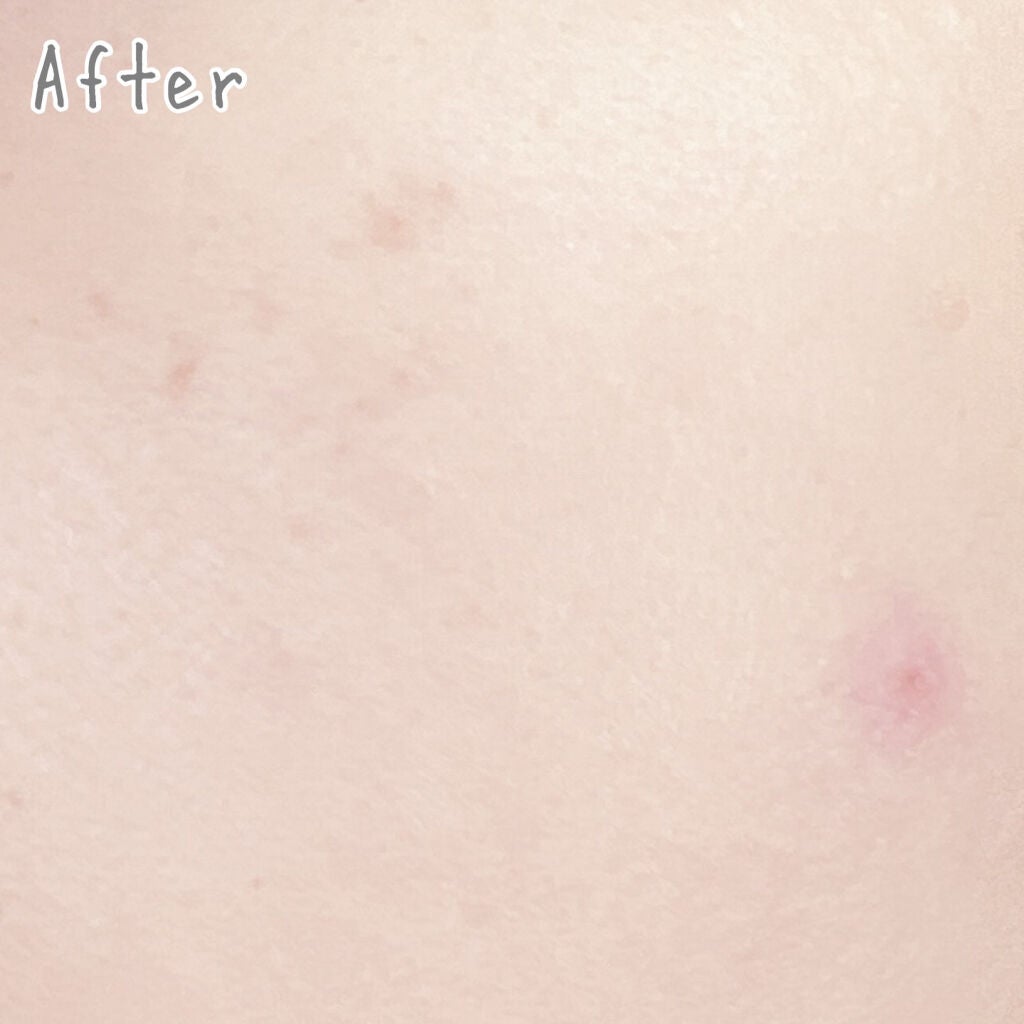 (旧)アンリミテッド ラスティング フルイド/shu uemura/リキッドファンデーションを使ったクチコミ(4枚目)