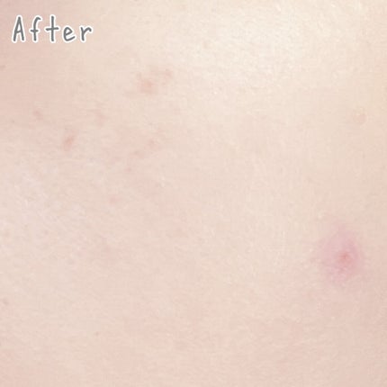 (旧)アンリミテッド ラスティング フルイド/shu uemura/リキッドファンデーションを使ったクチコミ(4枚目)