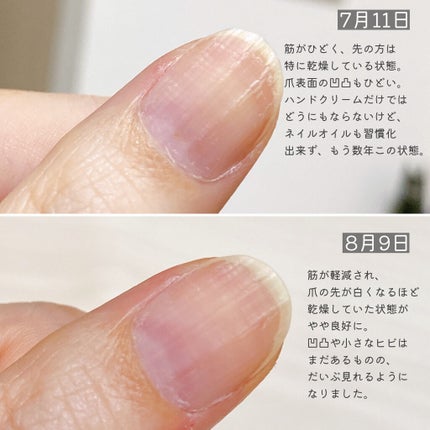 DHC 持続型ビオチン/DHC/美容サプリメントを使ったクチコミ(2枚目)