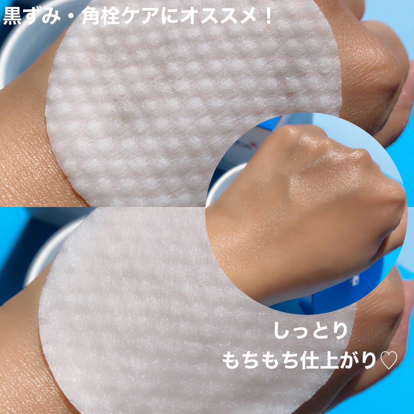 ゼロ毛穴パッド 2.0/MEDICUBE/トナーパッドを使ったクチコミ(5枚目)