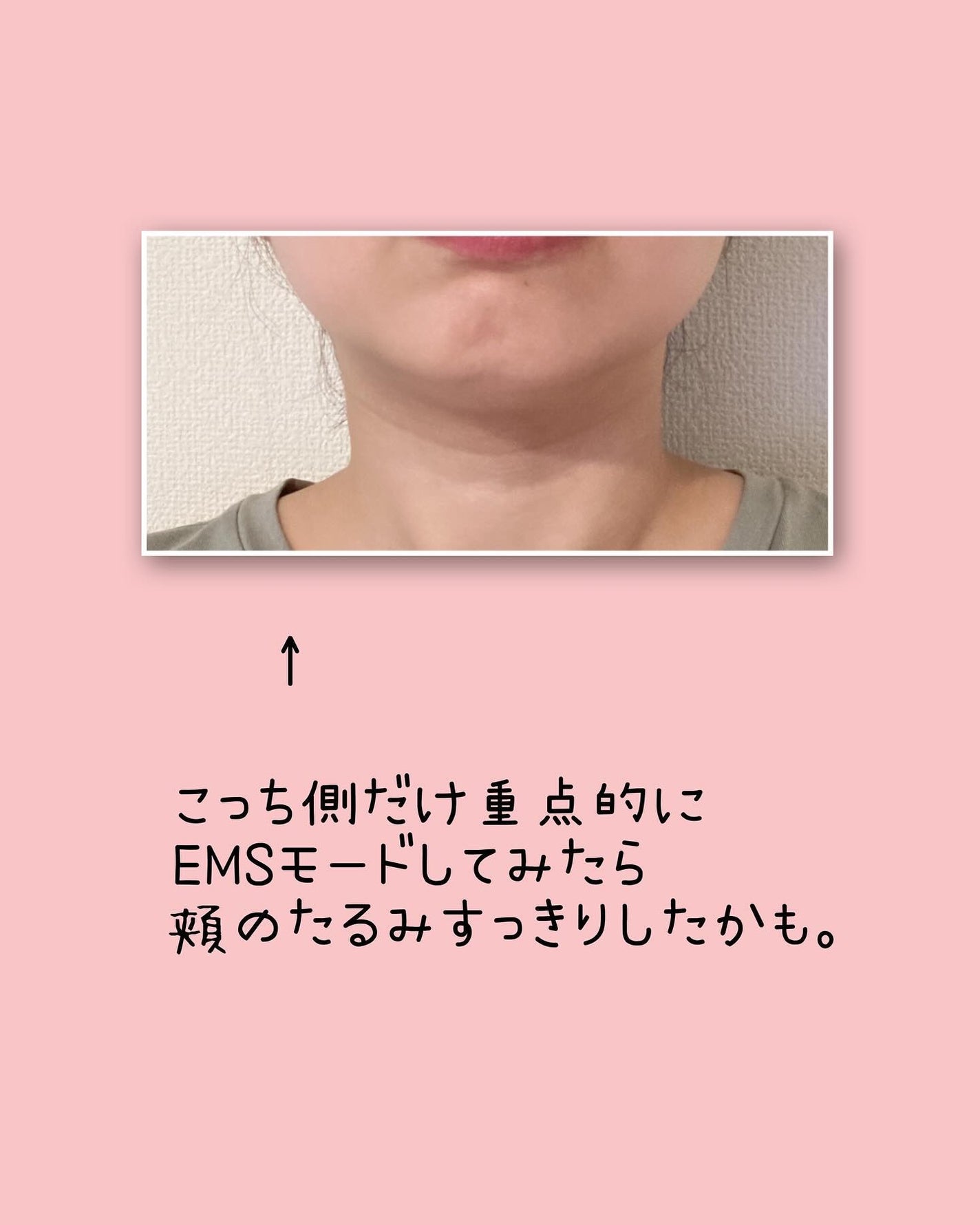 多機能温冷美顔器/ANLAN/美顔器・マッサージを使ったクチコミ(4枚目)