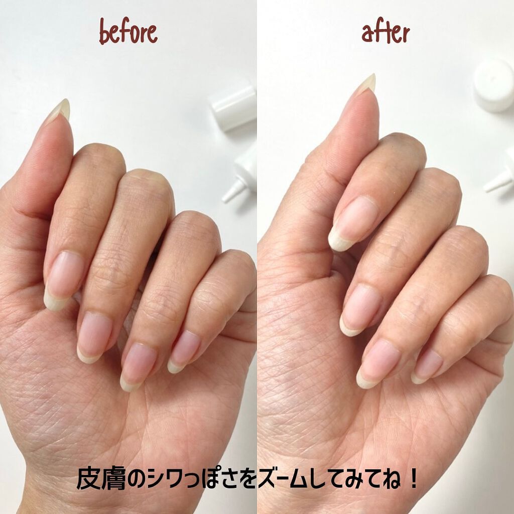 白ゆび姫/himecoto/ハンドクリームを使ったクチコミ(5枚目)