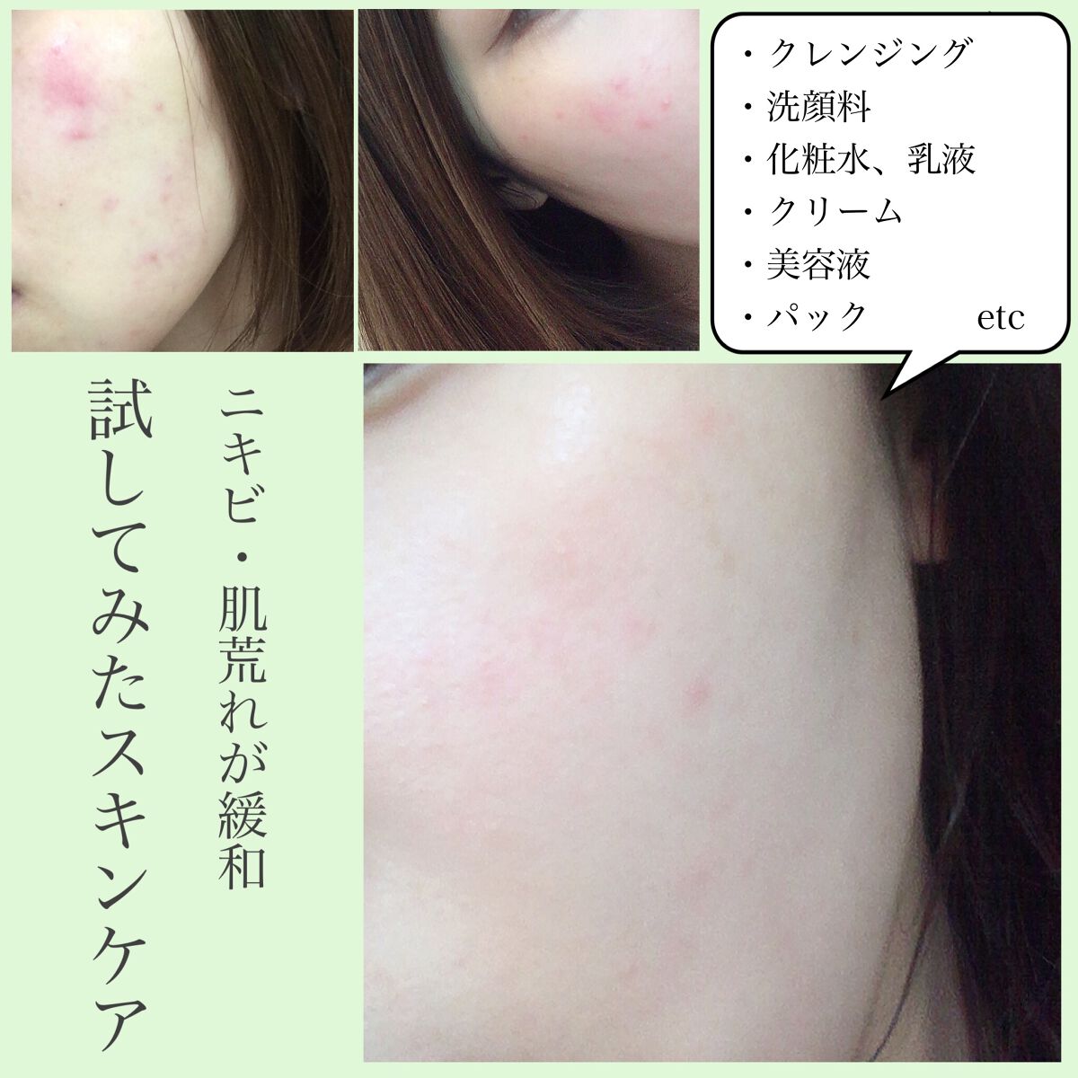 ハトムギ化粧水(ナチュリエ スキンコンディショナー R )/ナチュリエ/化粧水を使ったクチコミ（1枚目）