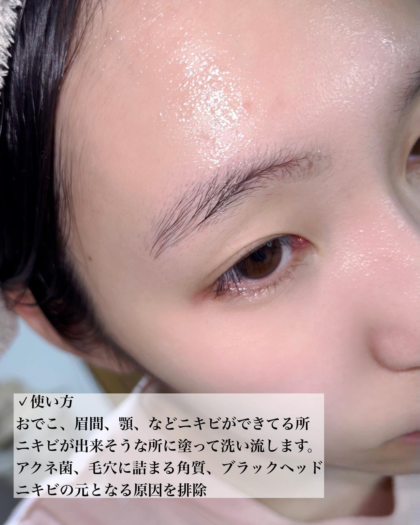 アクネウォッシュ23アンプル/Feld Apotheke/美容液を使ったクチコミ(5枚目)