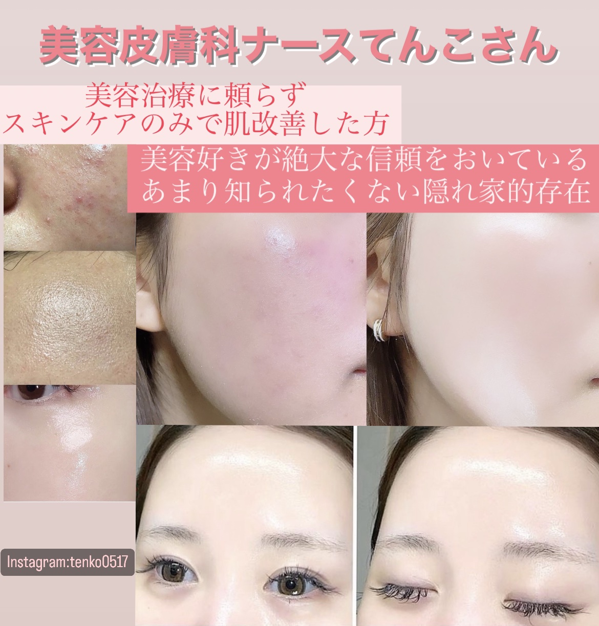 アリウル インクフェザーカバーラスティングクッション/Ariul/クッションファンデーションを使ったクチコミ（2枚目）