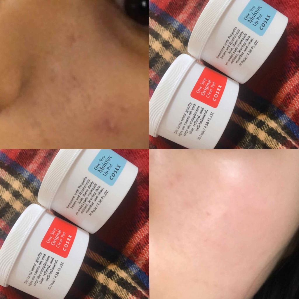 ワンステップモイスチャーアップパッド/COSRX/トナーパッドを使ったクチコミ（2枚目）