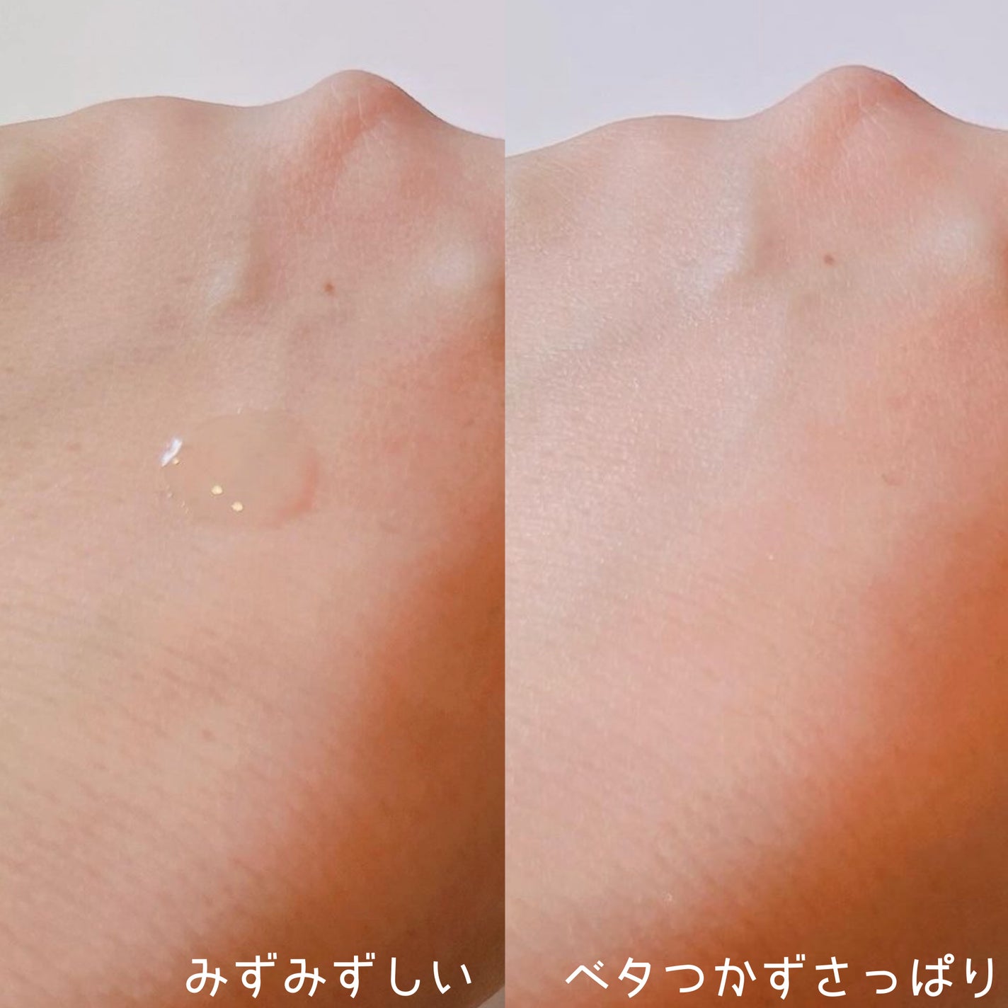 センテラ アンプル/SKIN1004/美容液を使ったクチコミ(3枚目)