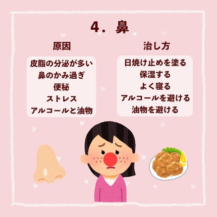 ペアアクネクリームW(医薬品)/ペア/その他を使ったクチコミ(5枚目)