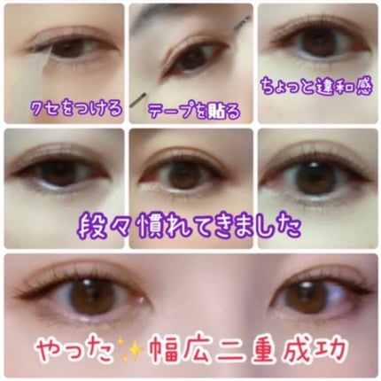 マイクロファイバー /ビー・エヌ/二重まぶた用アイテムを使ったクチコミ(5枚目)