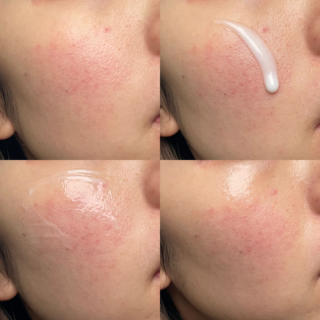 ホワイト ピュアアクティブ GL/エタピュール/美容液を使ったクチコミ（2枚目）