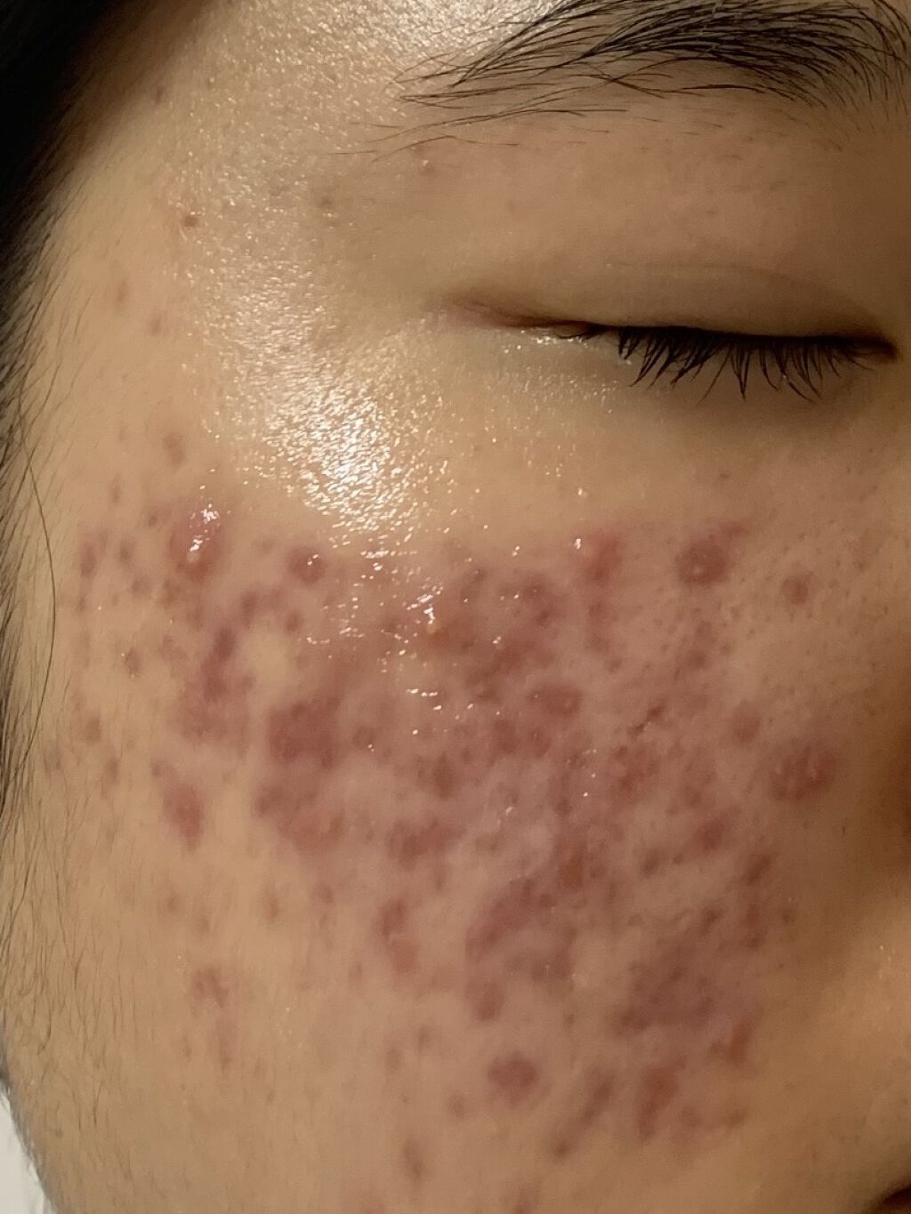 白色ワセリン(医薬品)/健栄製薬/その他を使ったクチコミ（2枚目）