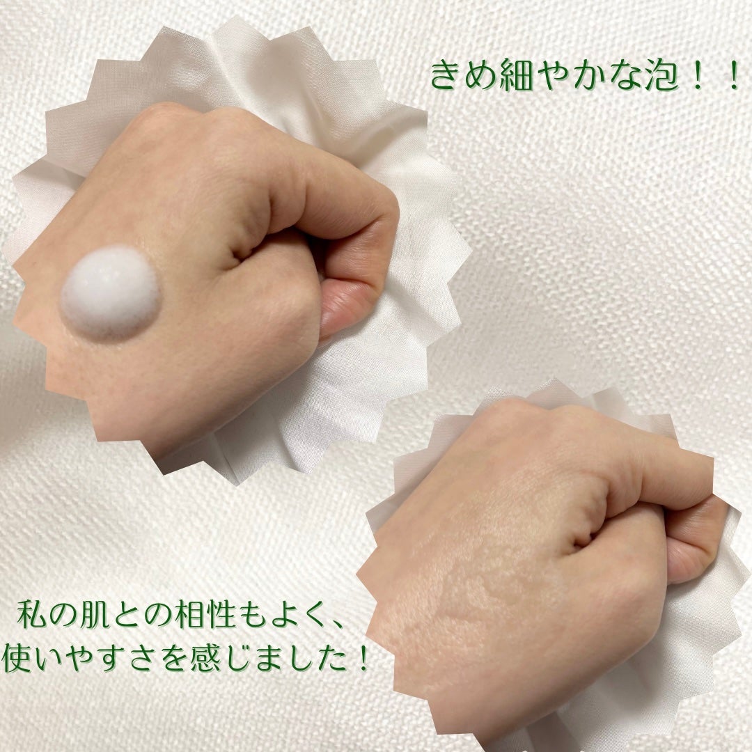 バランシングシカブレミッシュバブルクレンザー/Roume/泡洗顔を使ったクチコミ(3枚目)