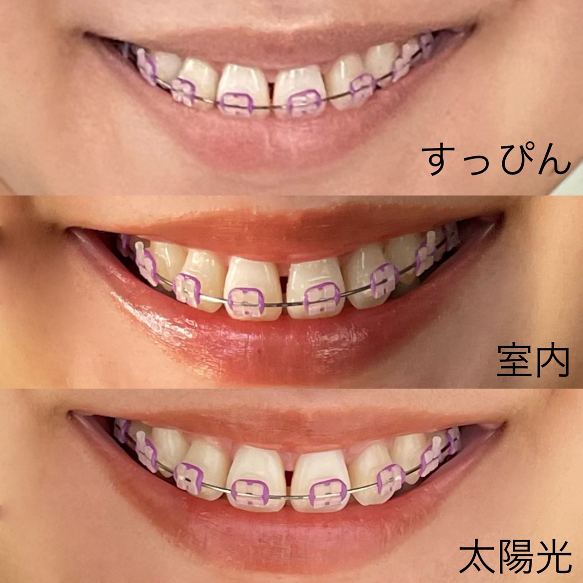 ルージュ ピュールクチュール ヴェルニ ヴィニルクリーム No.610 ヌード チャンピオン/YVES SAINT LAURENT BEAUTE/口紅を使ったクチコミ（2枚目）