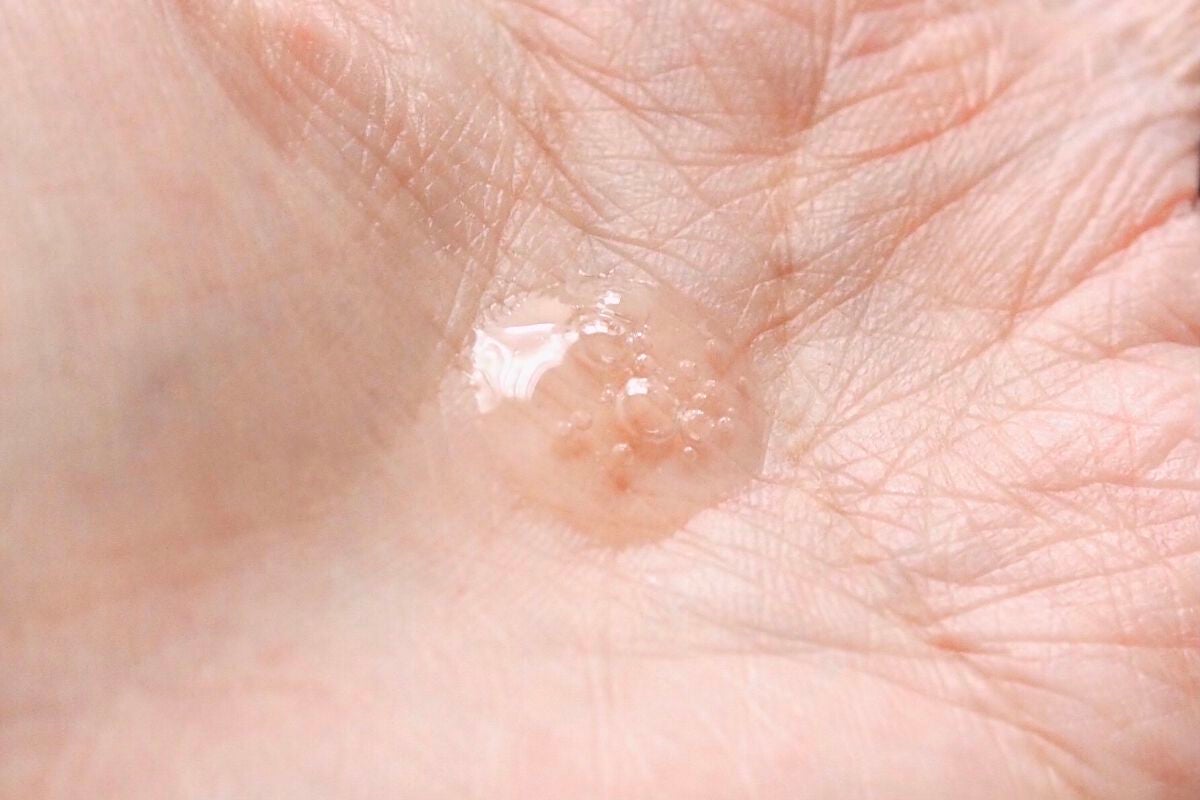 HCケアセラム/allNATURAL/美容液を使ったクチコミ(4枚目)